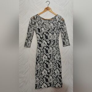 Lipsy Black Dress with White Floral Lace Overlay